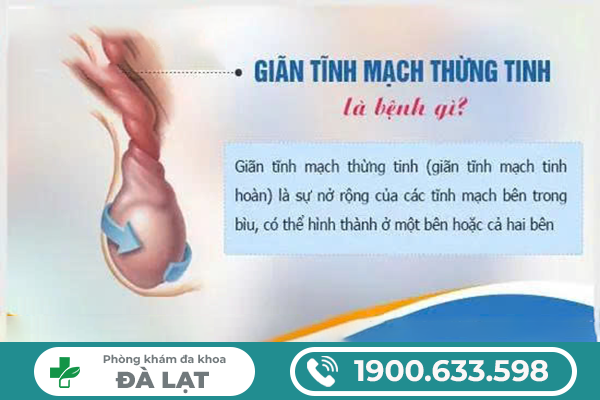 Hình ảnh minh họa